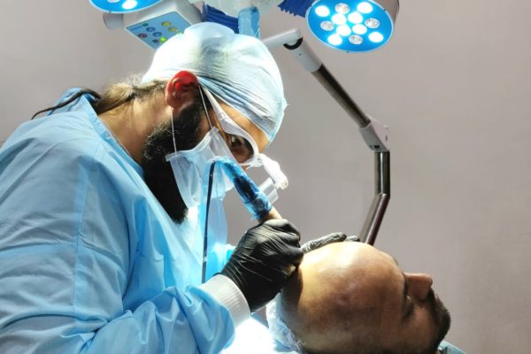 Scalp micropigmentation hair treatment Scalp micropigmentation hair treatment